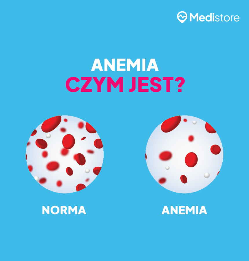 Czym jest anemia?